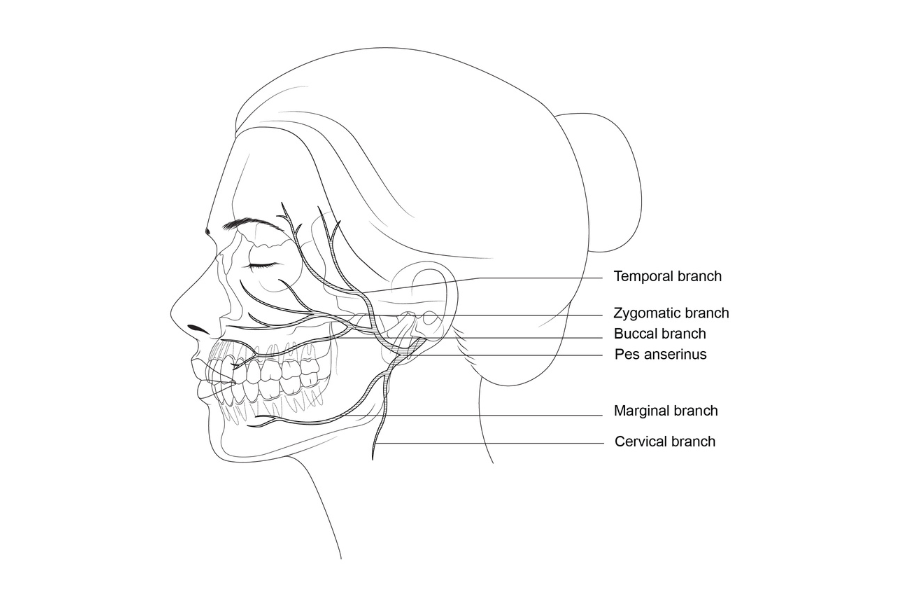 Medical line drawing- Facial nerve