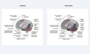 Brain graphic